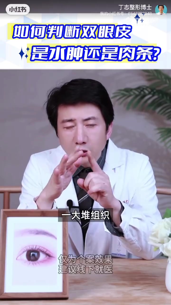 双眼皮术后,如何判断是水肿还是肉条?