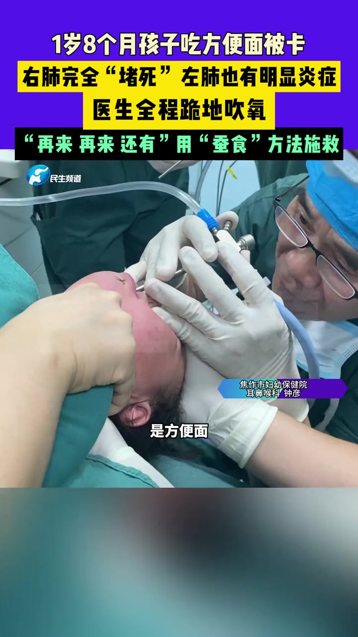 3月9日河南焦作:1岁8个月孩子吃方便面被卡,右肺完全“堵死”,左肺也有明显炎症,医生全程