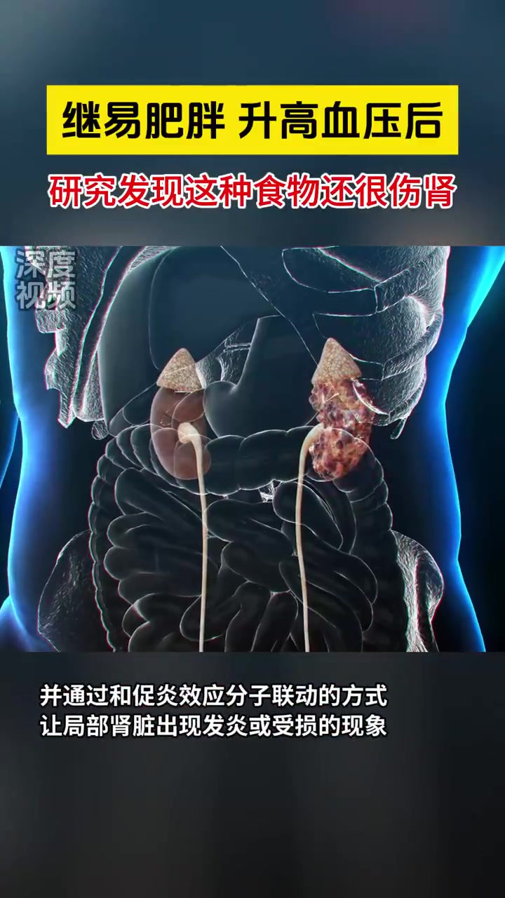 研究称常吃超加工食物或伤肾 继易肥胖、升高血压后,研究发现超加工食物还很伤肾。此前,一来自