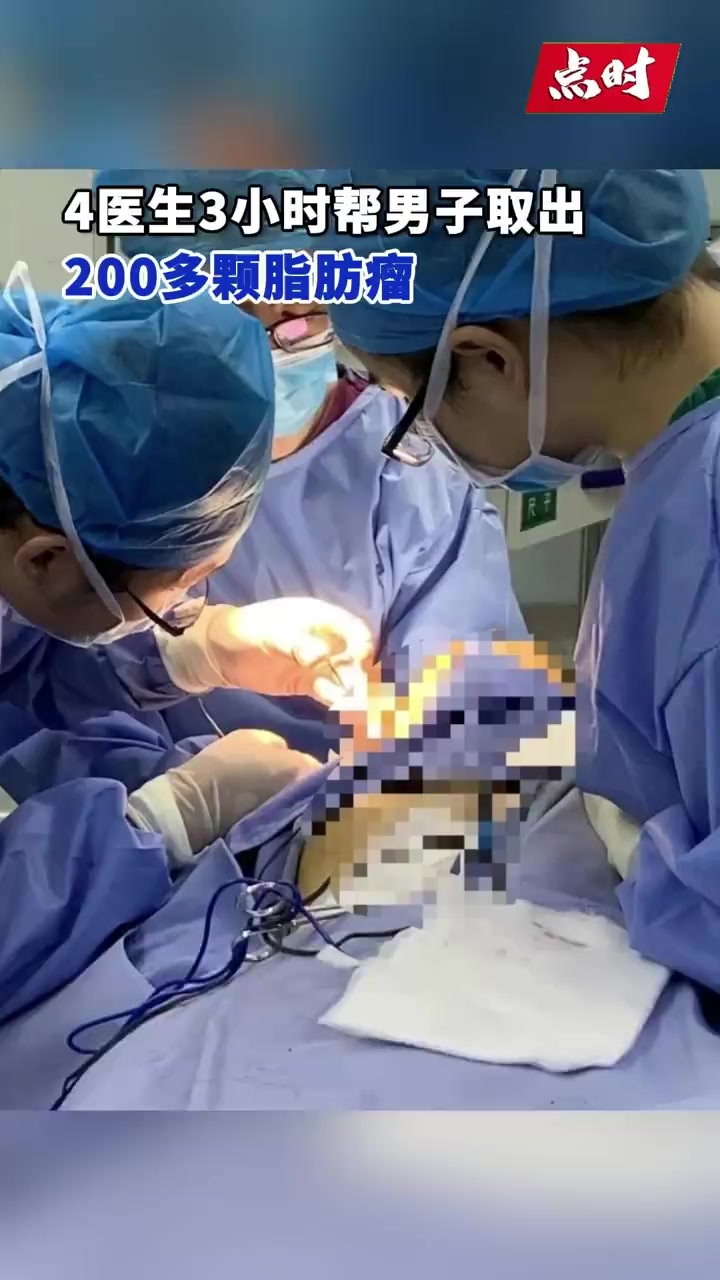 「4医生3小时帮男子取出200多颗脂肪瘤」近日,湖北武汉,一46岁男子全身堆积200余颗脂
