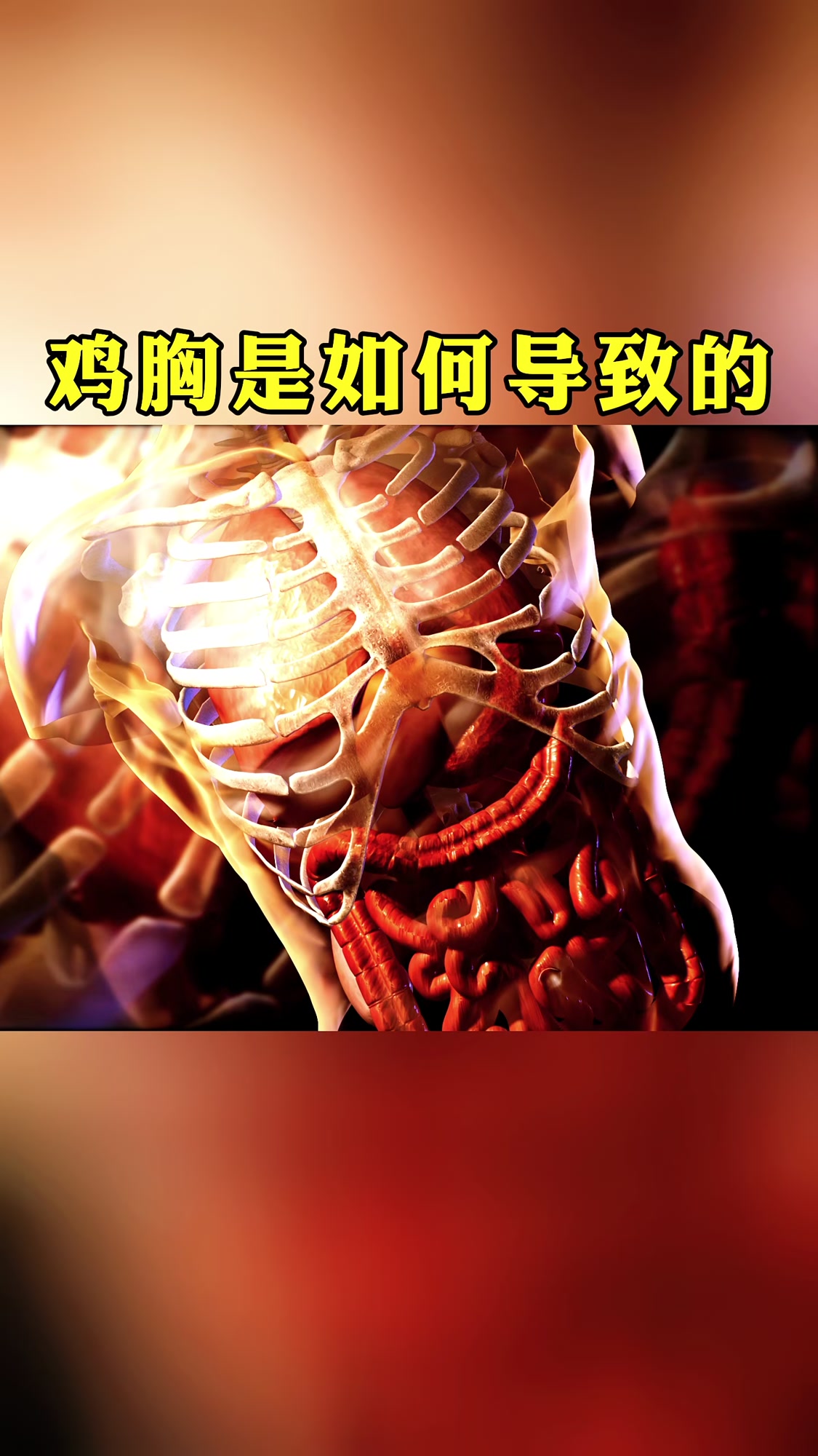 鸡胸是如何导致的