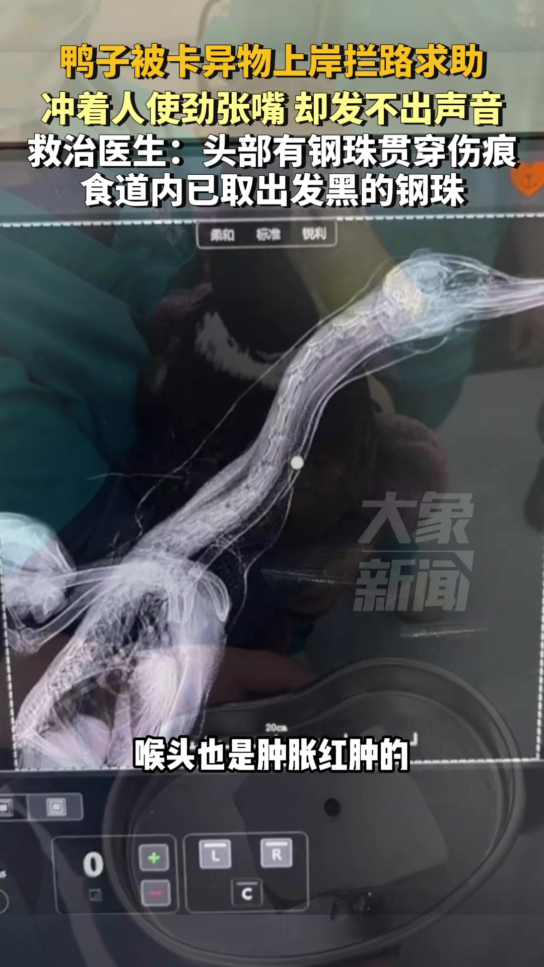 鸭子被卡异物上岸拦路求助,冲着人使劲张嘴却发不出声音