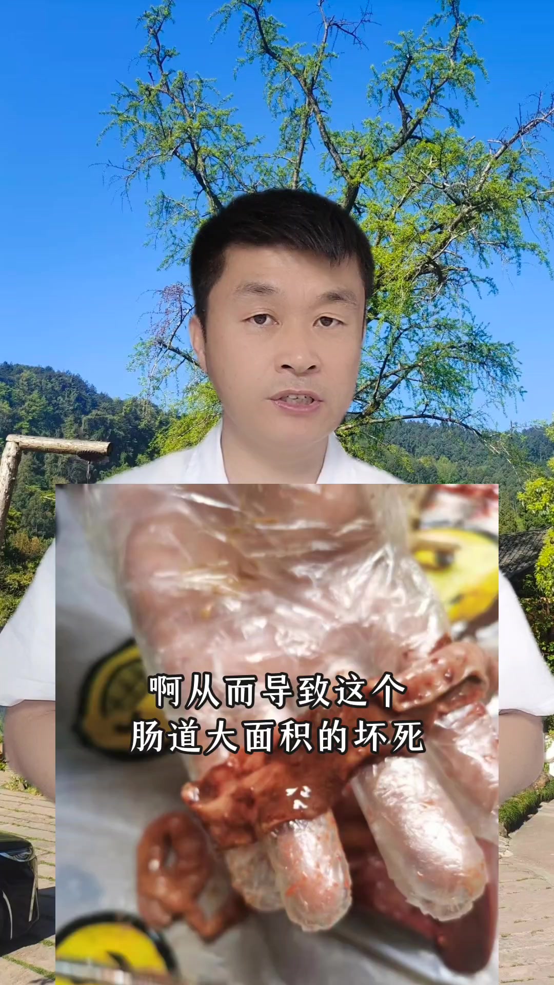 坏死性肠炎,为啥没治好?