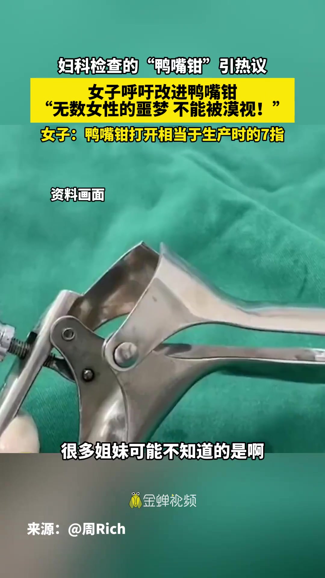 妇科检查的“鸭嘴钳“引热议,女子呼吁改进鸭嘴钳“无数女性的噩梦 不能被漠视!女子:鸭嘴钳打