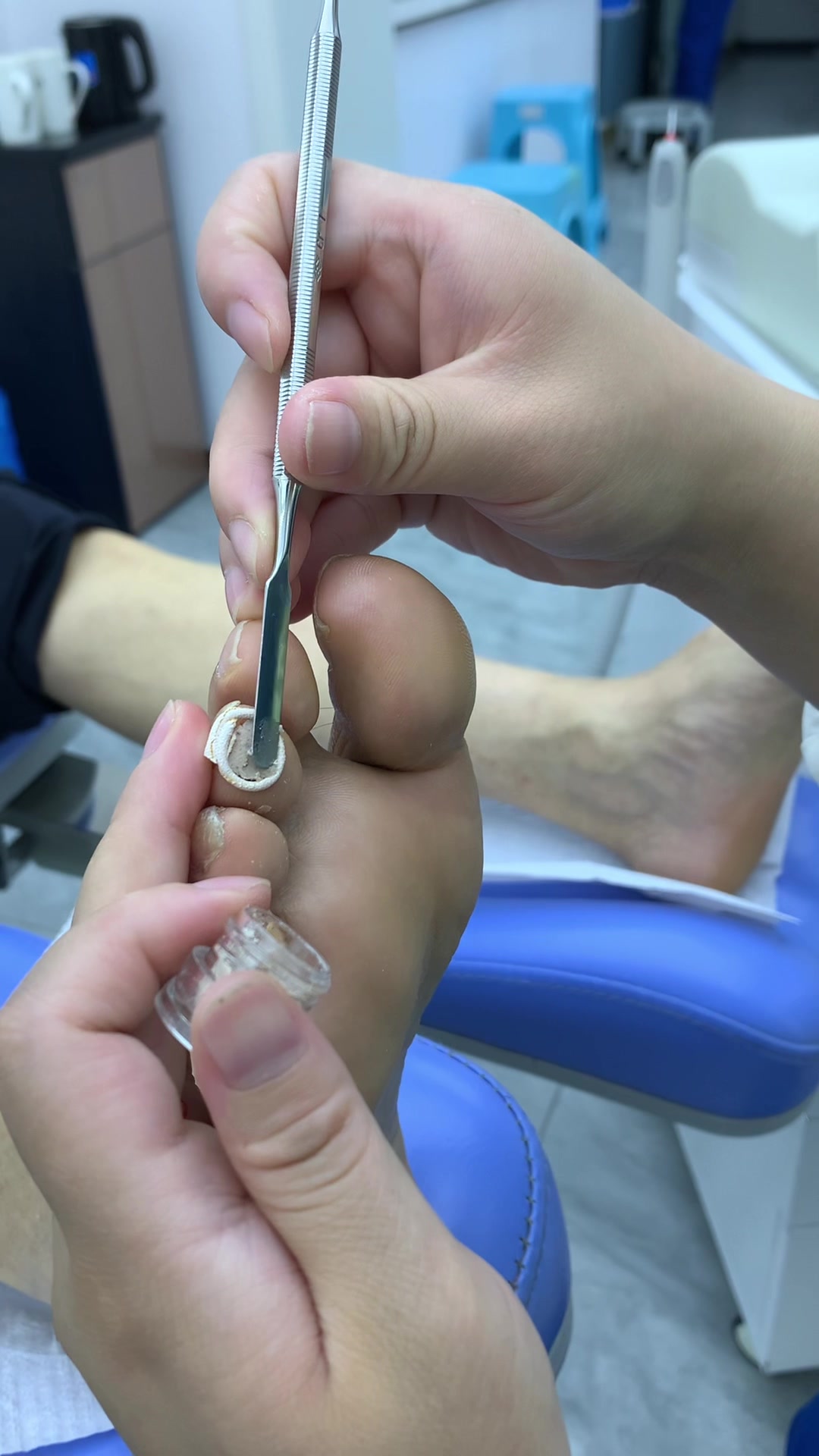 脚上长鸡眼该怎么办