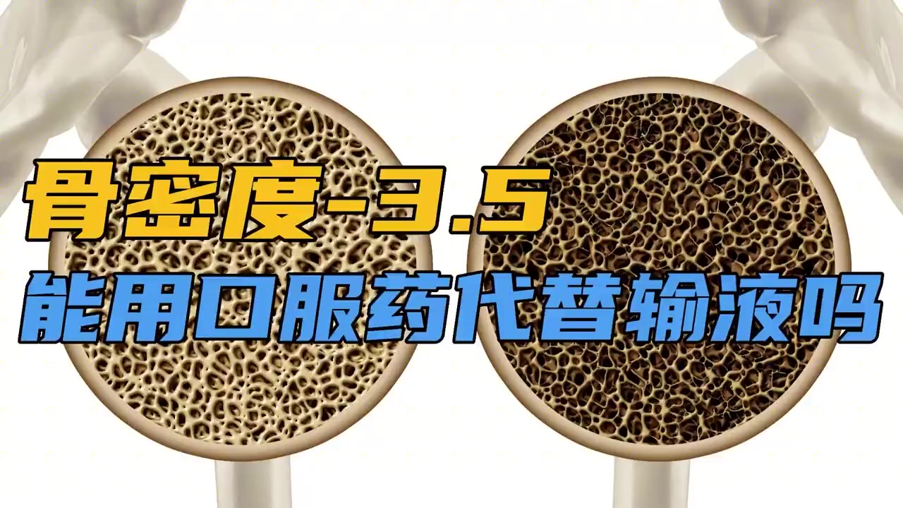 骨密度-3.5,骨质疏松可以只用服药医治吗?