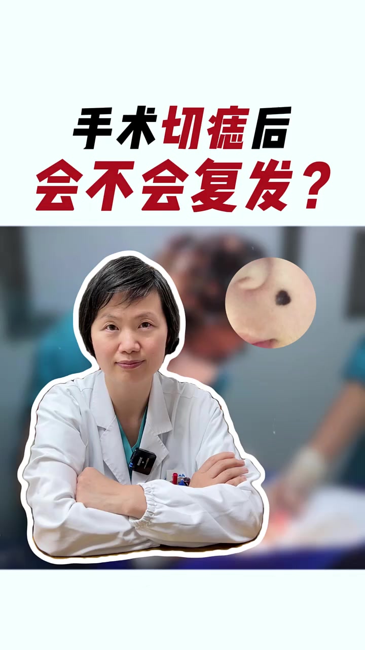 手术切痣后会不会复发?痣 科普