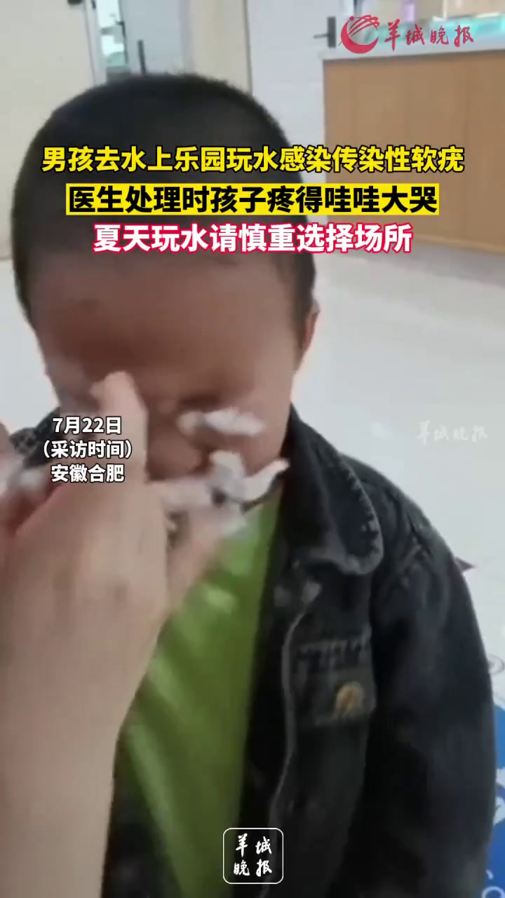 去了趟水上乐园,男孩脸上出现“小肉粒”!戏水警惕“泳池病”