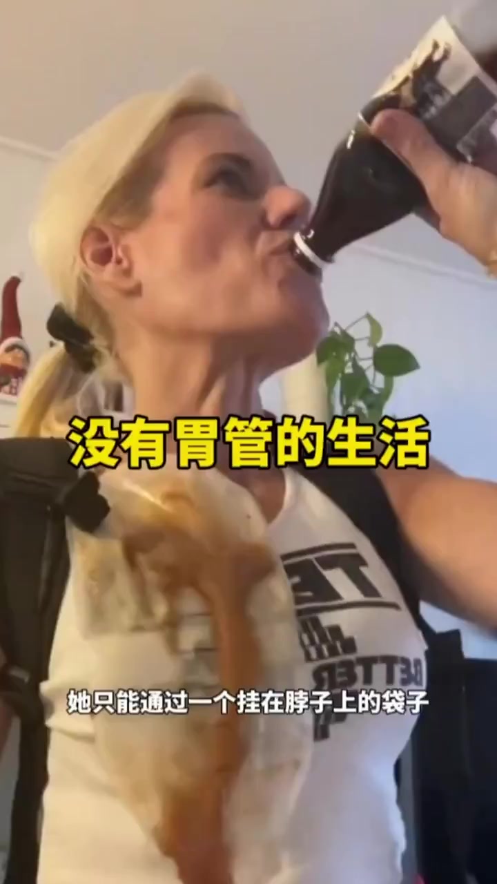小姐姐,无胃管,生活依然精彩!