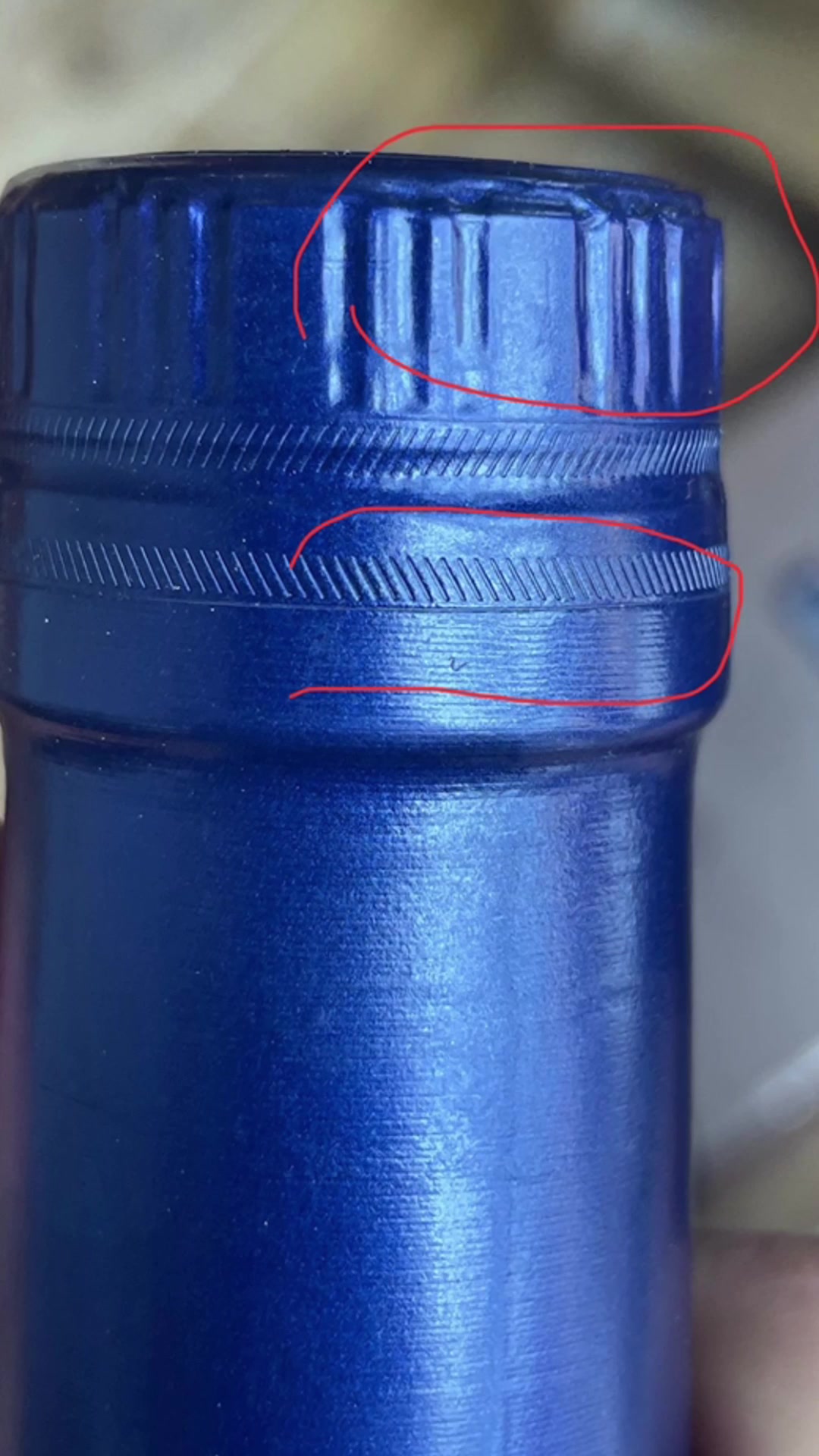 鹅口疮,难缠的口腔“白膜”