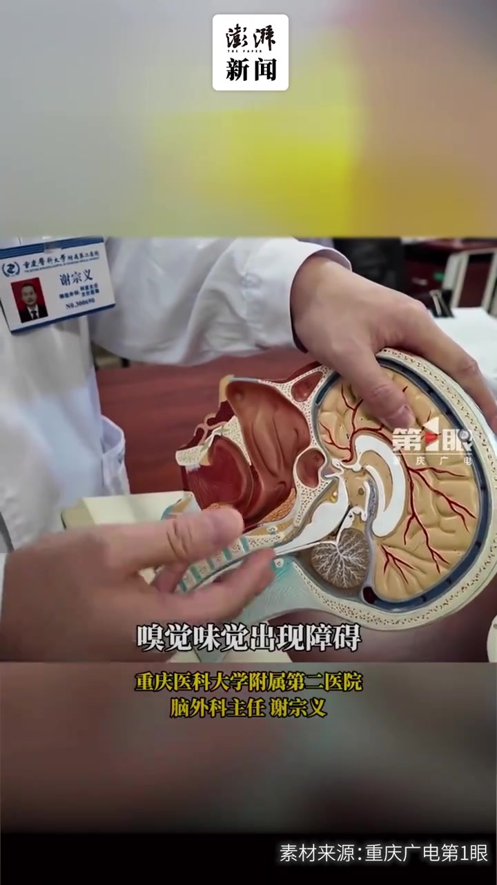 外科主任解释“鲨鱼夹伤人”:受到外力撞击,夹子易嵌入头骨骨缝