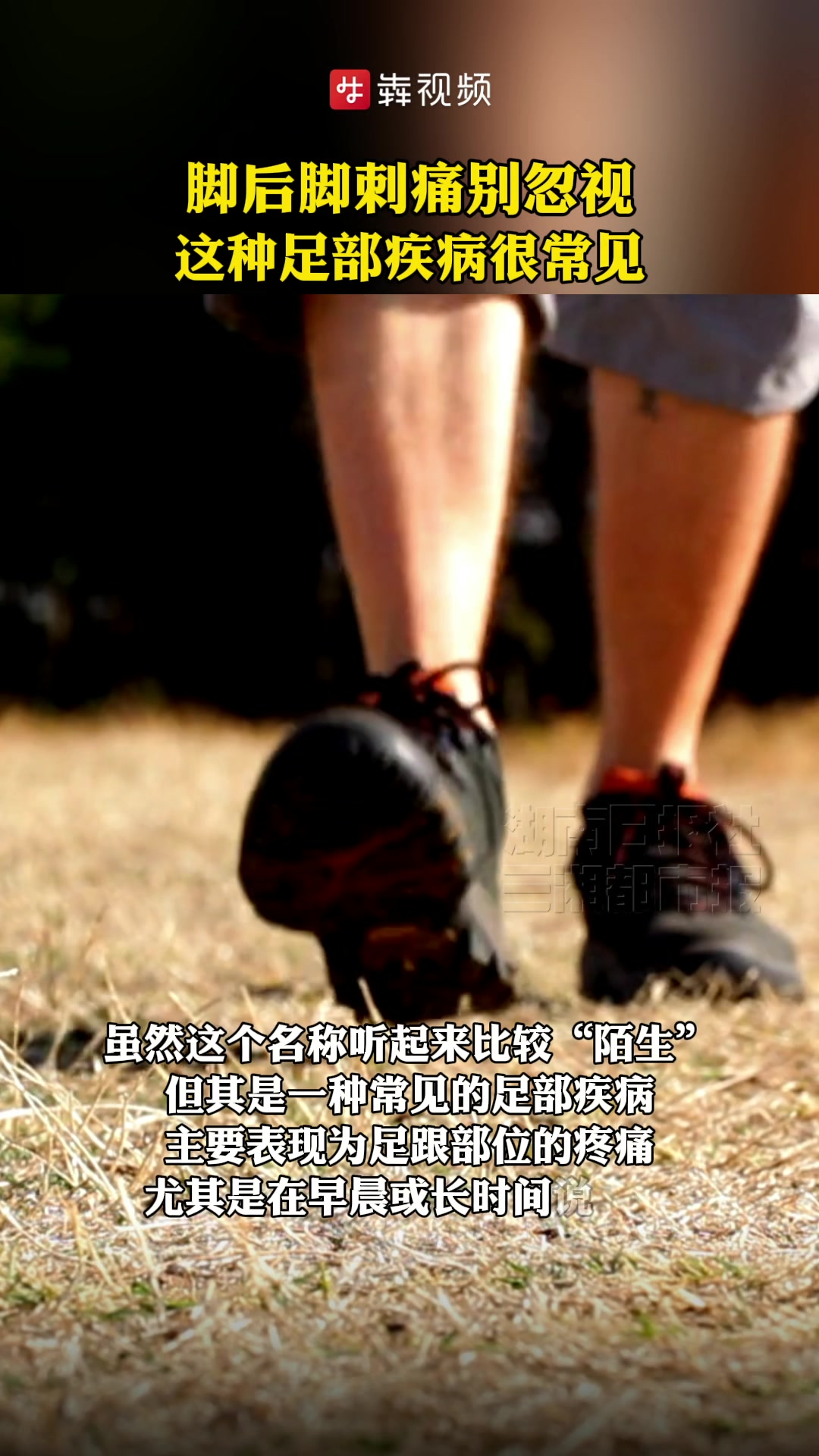 脚后跟刺痛别忽视,这种足部疾病很常见