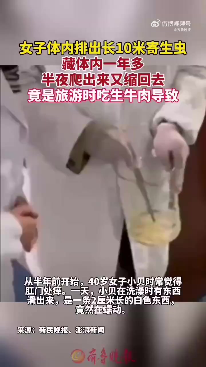 上海,据新民晚报报道,从半年前开始,40岁女子小贝时常觉得肛门处痒痒的,晚上尤其刺痒难忍,