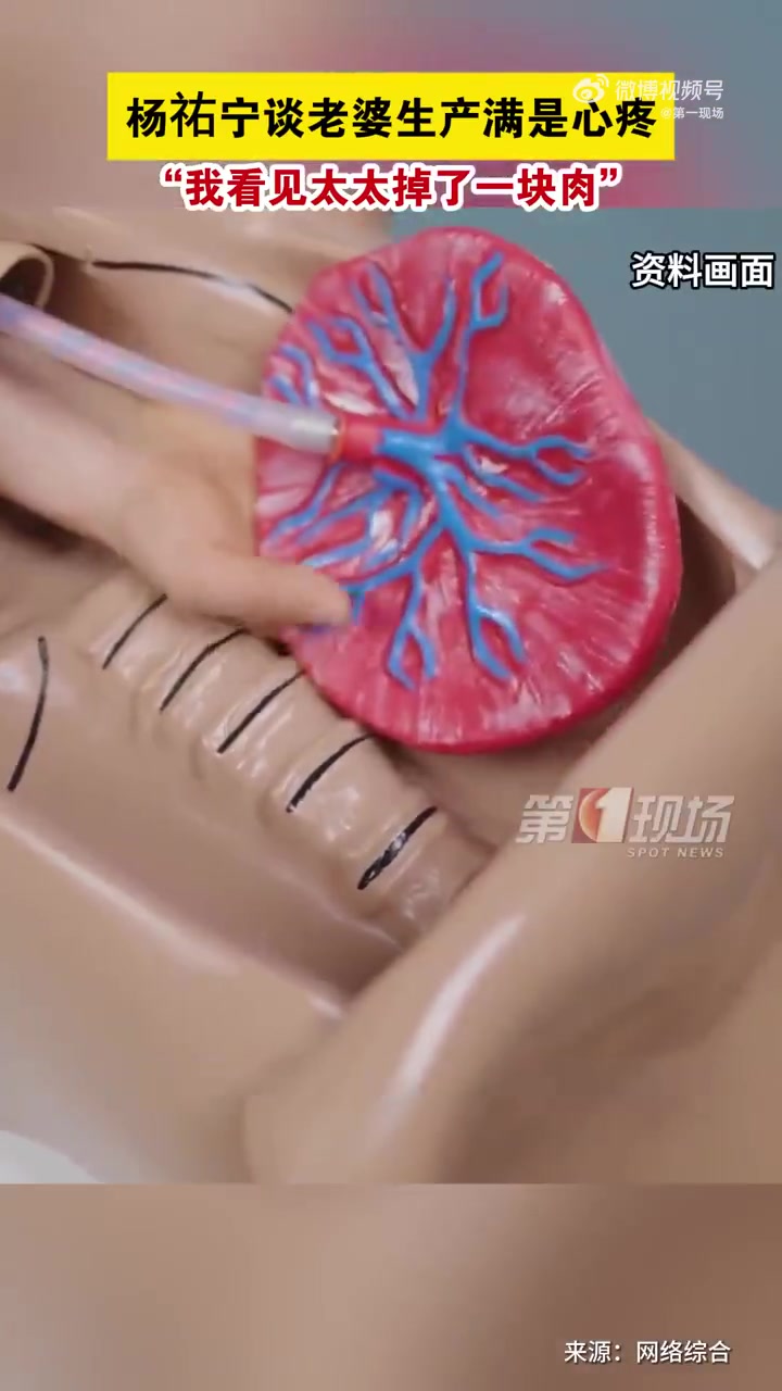 杨祐宁聚会时,讲到老婆生产满是心疼。他让大家传酒瓶感受一块胎盘的重量,“你想象你现在身上就