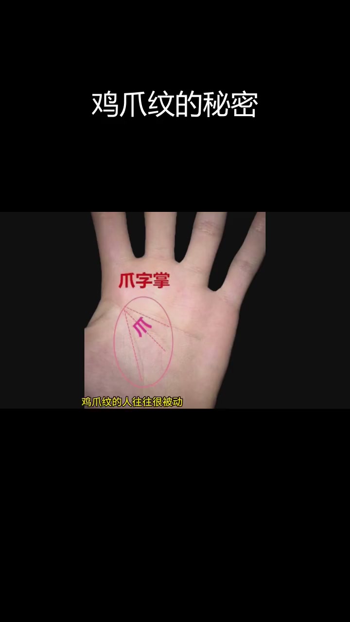 鸡爪纹掌纹揭示的健康与情感挑战
