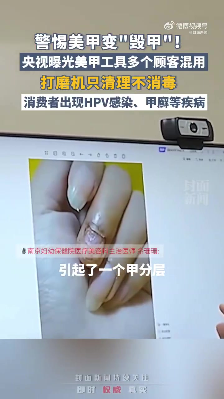 「做美甲可能感染hpv病毒?医生提醒:小心“美甲”变“毁甲”」春节前美甲生意爆火 近日,湖