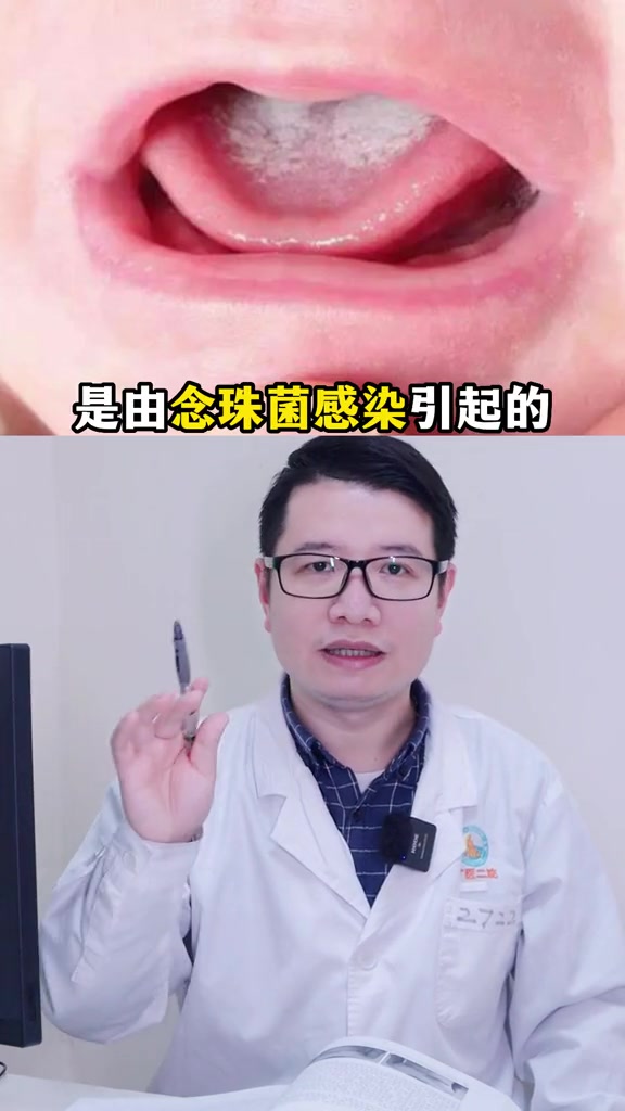 嘴唇舌头上总是白白的,像奶渍一样,用纸巾擦也擦不掉要注意!