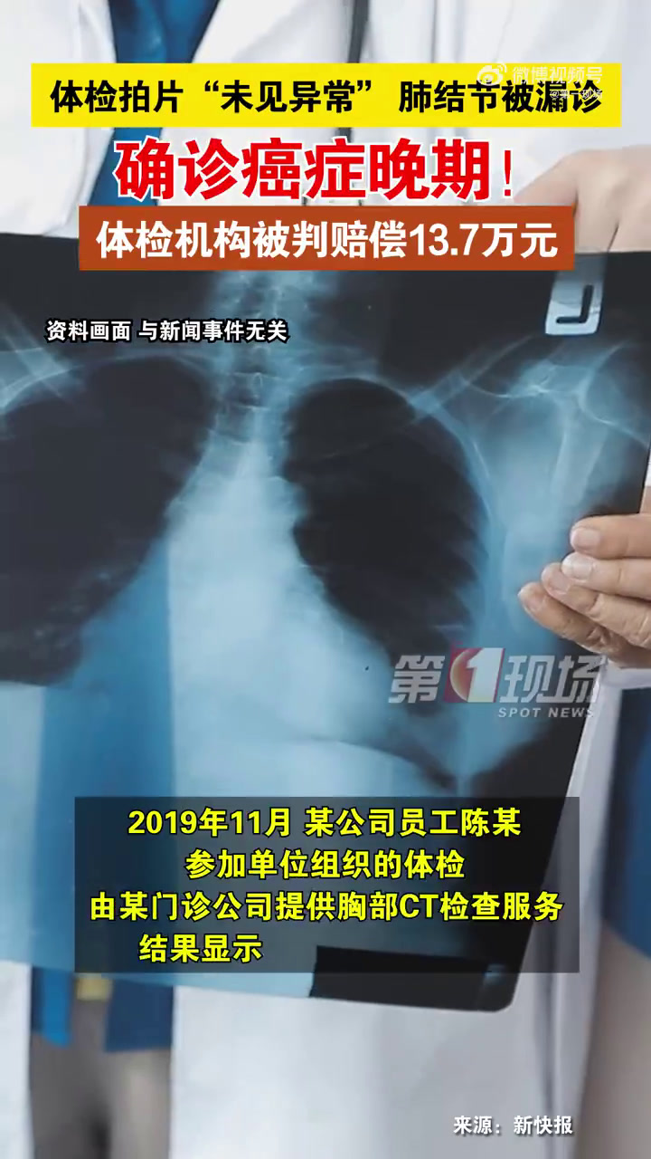 「「惊哭」男子体检未见异常却确诊肺癌晚期 广东一体检机构被判赔偿13.7万元」男子体检被漏