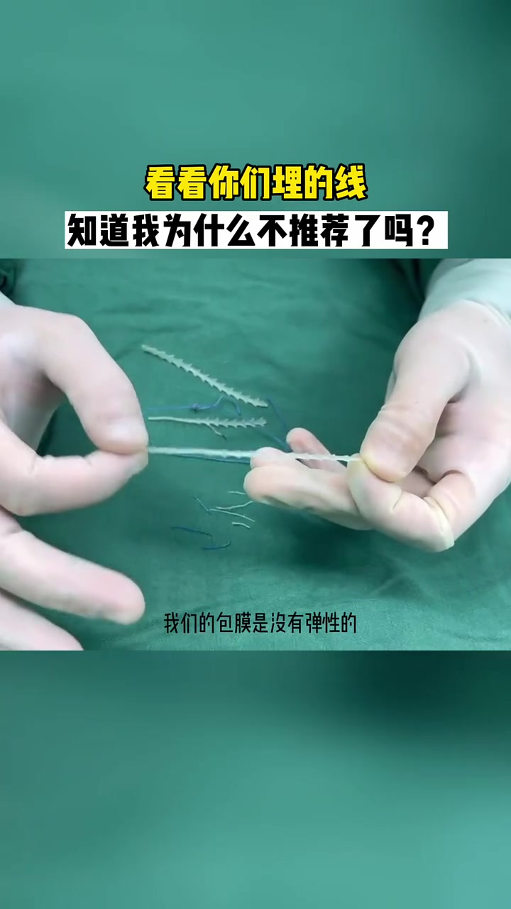 看看你们面部埋的线,知道我为什么不推荐了吧!