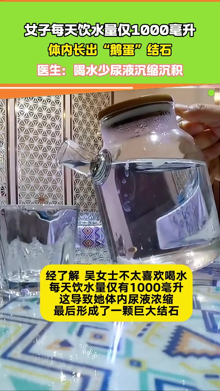 女子每天饮水量仅1000毫升 体内长出鹅蛋结石!