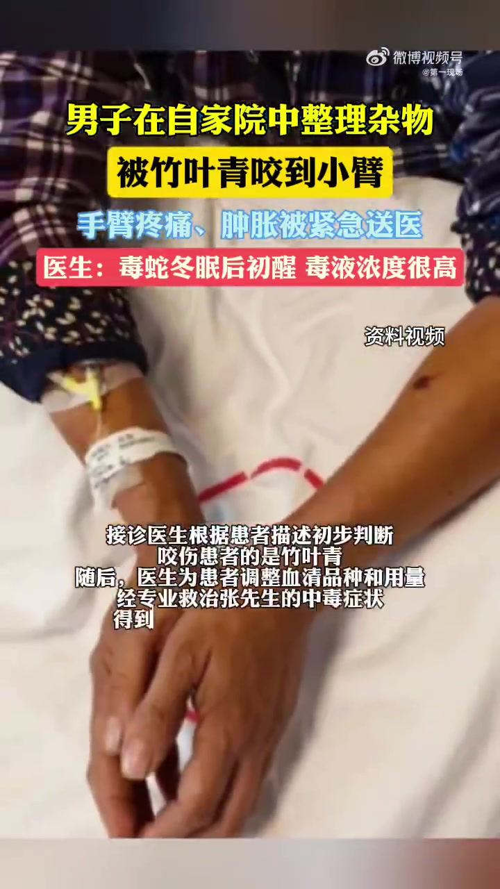 「春季毒蛇苏醒小心伤人!广东一男子在家中被毒蛇咬伤」广东一男子在家被竹叶青蛇咬伤 近日,广