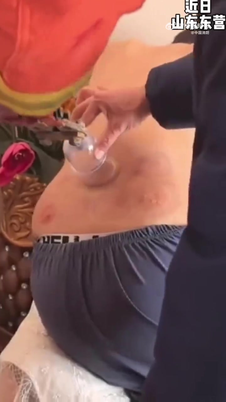 近日,山东东营,男子自己在家拔火罐,由于操作不慎难以取下,尝试多种办法实在没辙且疼痛难忍,