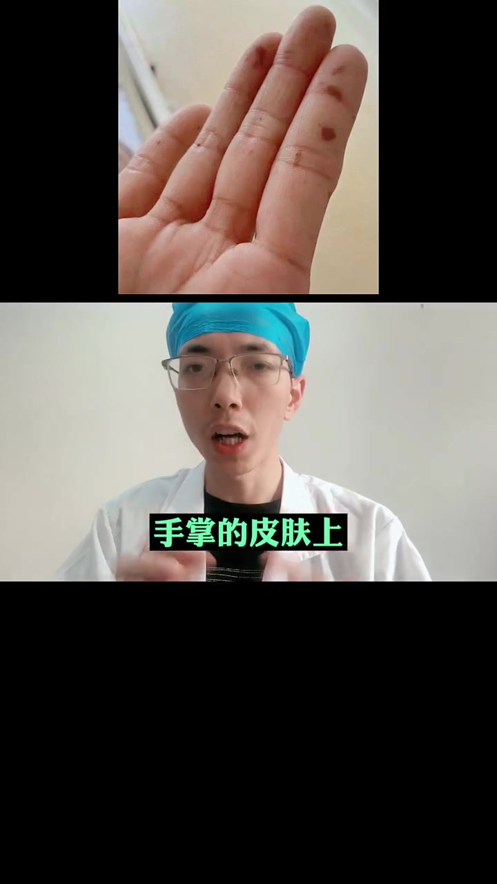 皮肤长这个,一定要注意,可能是肠息肉