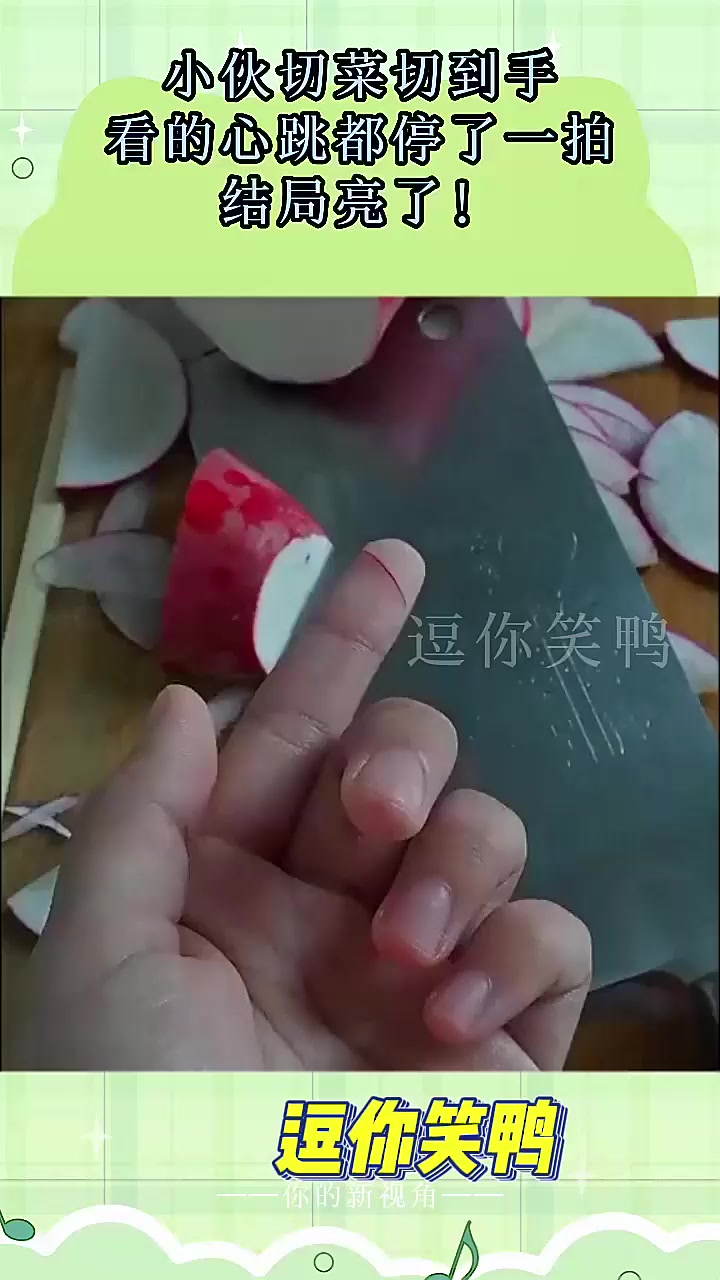 小伙切菜切到手,看的心跳都停了一拍,结局亮了!