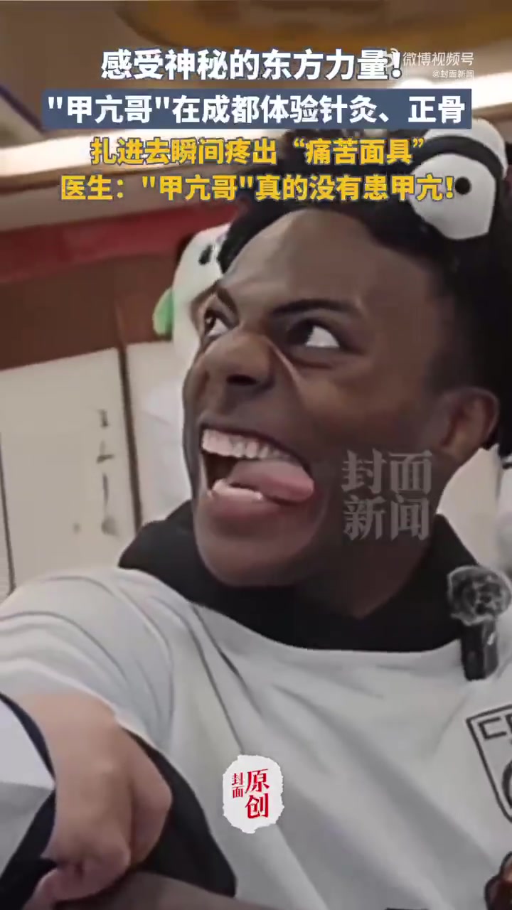 「感受“神秘的东方力量” 甲亢哥针灸正骨后已老实」神秘东方力量证实甲亢哥没甲亢3月31日,