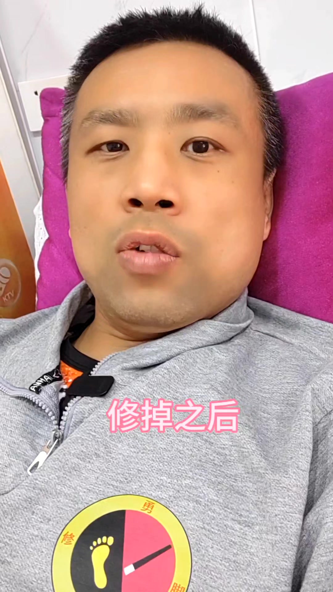这个东西是鸡眼不是茧