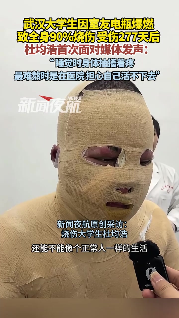 4月12日,江西 新余。武汉大学生因室友电瓶爆燃,致全身90%烧伤。受伤277天后,杜均浩