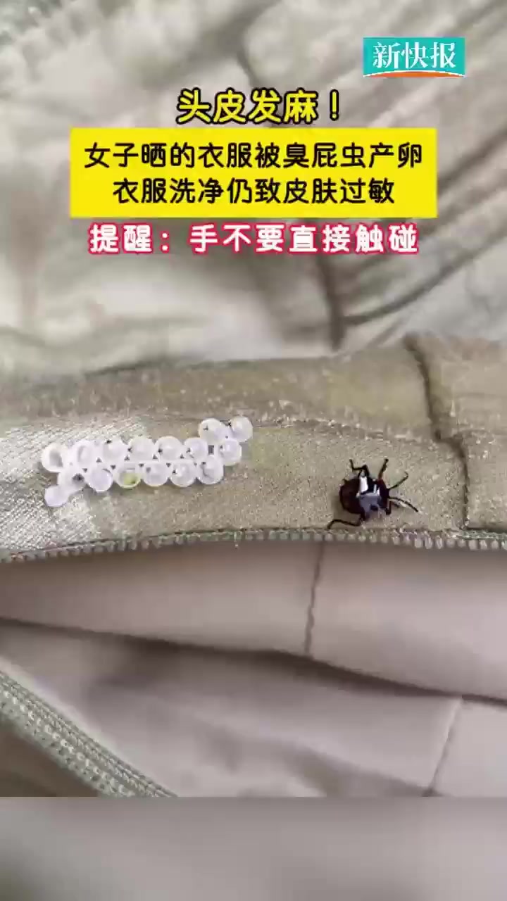 近日,广东。女子收衣服时发现衣服上竟沾有14粒虫卵,洗完衣服穿上致脖子过敏。其实,这些都是