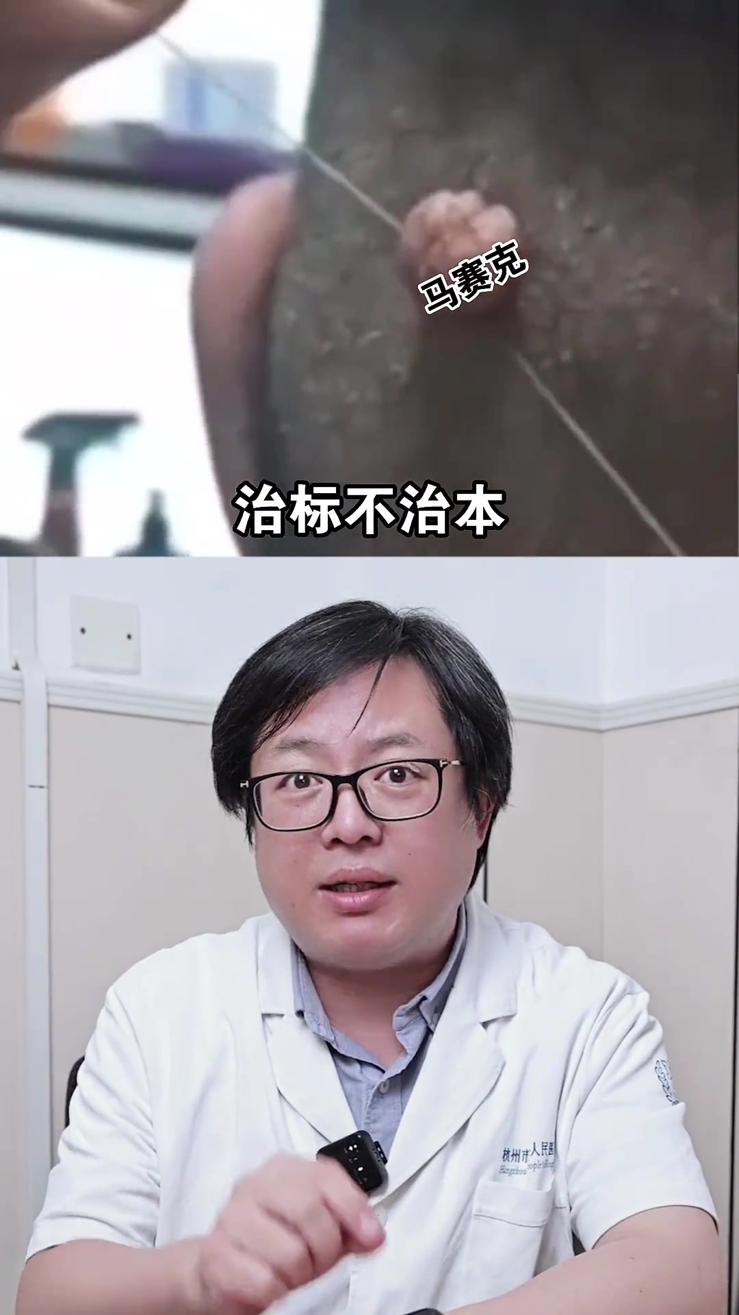 你有拿线缠绕去除过身上的小肉疙瘩吗？