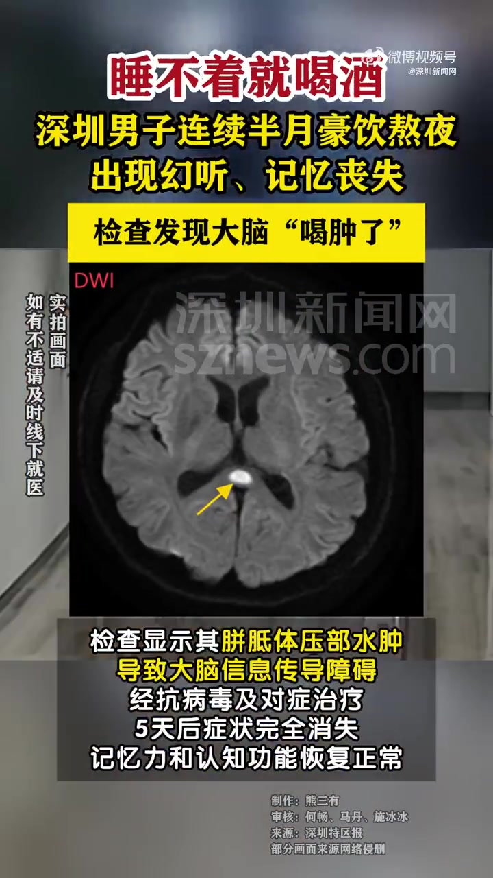 「男子连续15天熬夜酗酒致脑水肿」近日,深圳35岁设计师董先生回老家参加婚礼、聚会,连续1
