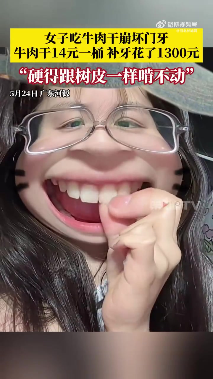 5月25日(发布),广东河源。女子吃牛肉干崩坏门牙,14元一桶的牛肉干让她痛失1300元补