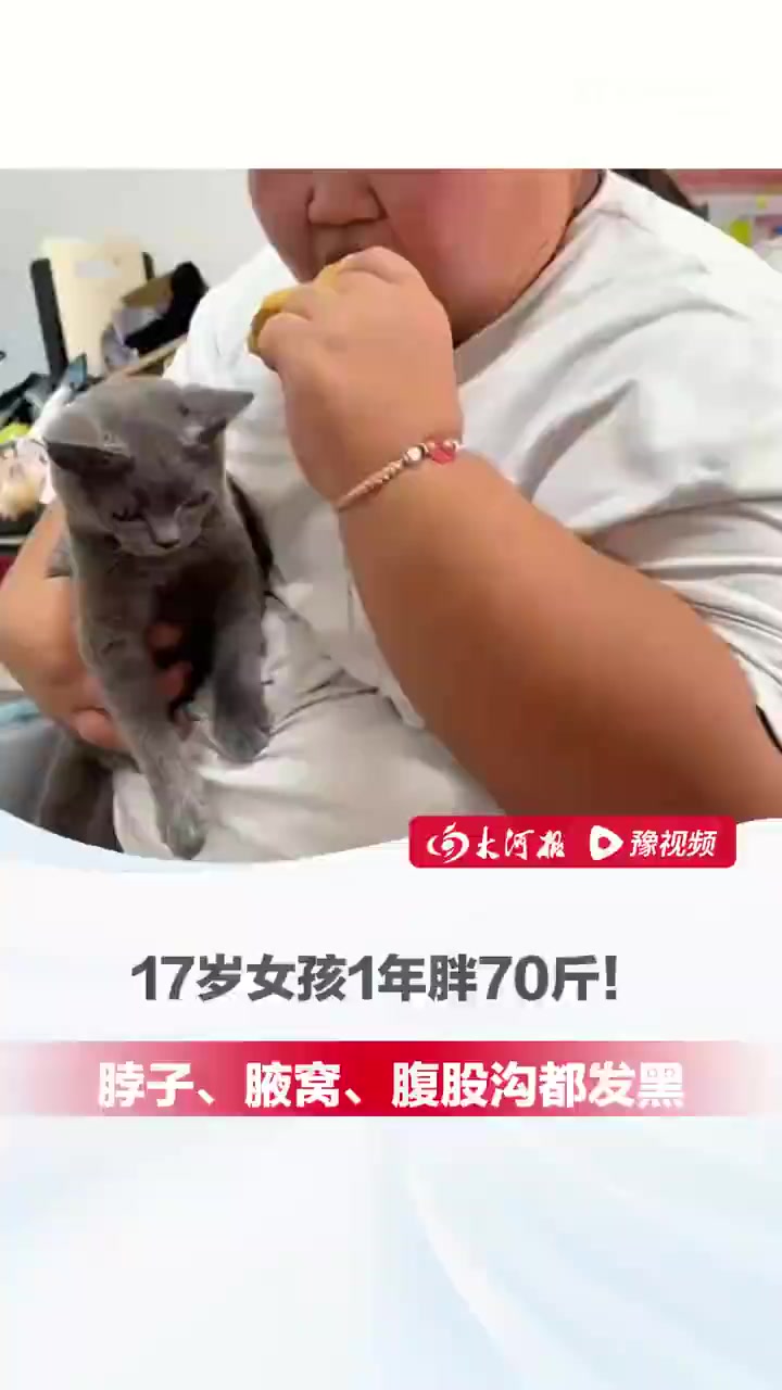 「17岁女孩一年胖70斤」近日,江苏南京。17岁女孩一年胖70斤,脖子、腋窝、腹股沟都发黑