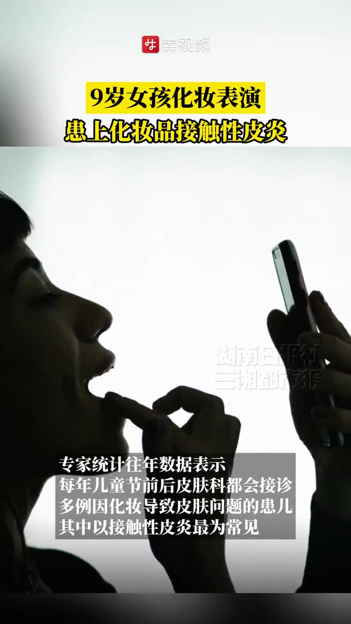 今年的“六一”国际儿童节,9岁的小雨(化名)是在湖南省儿童医院皮肤科诊室里度过。因为一次看