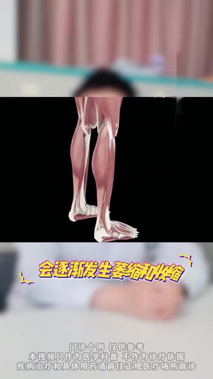 女生小腿肌肉发达如何改善呢