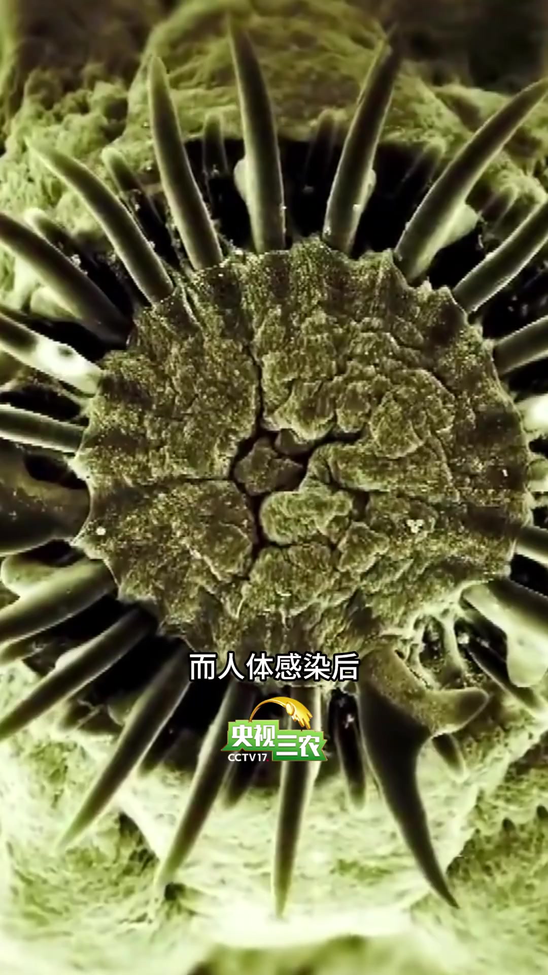 为啥牛肉可以生吃,猪肉却必须全熟?