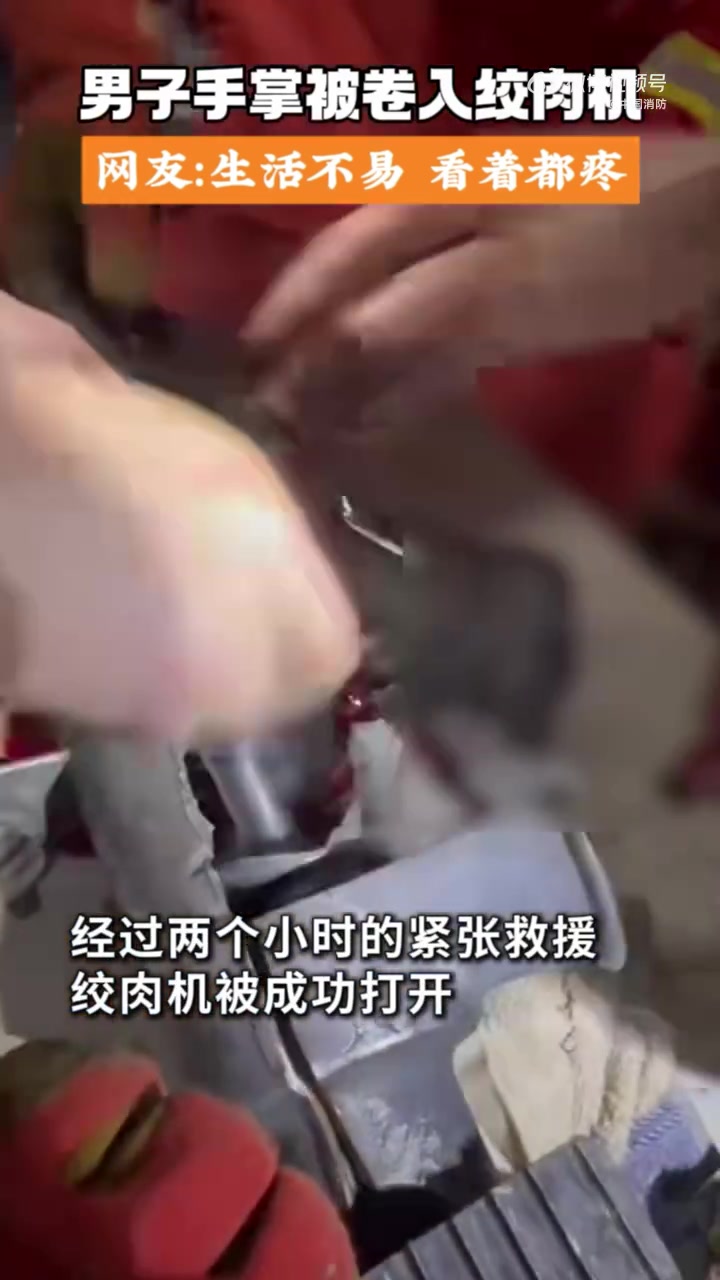 一男子手掌被绞肉机死死“咬”住,情况紧急!贵州消防 到场后拆开绞肉机外壳,扩大救援空间。随