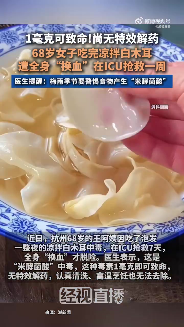 近日,杭州68岁的王阿姨因吃了泡发整夜的凉拌白木耳中毒,在icu抢救7天,全身“换血”才脱