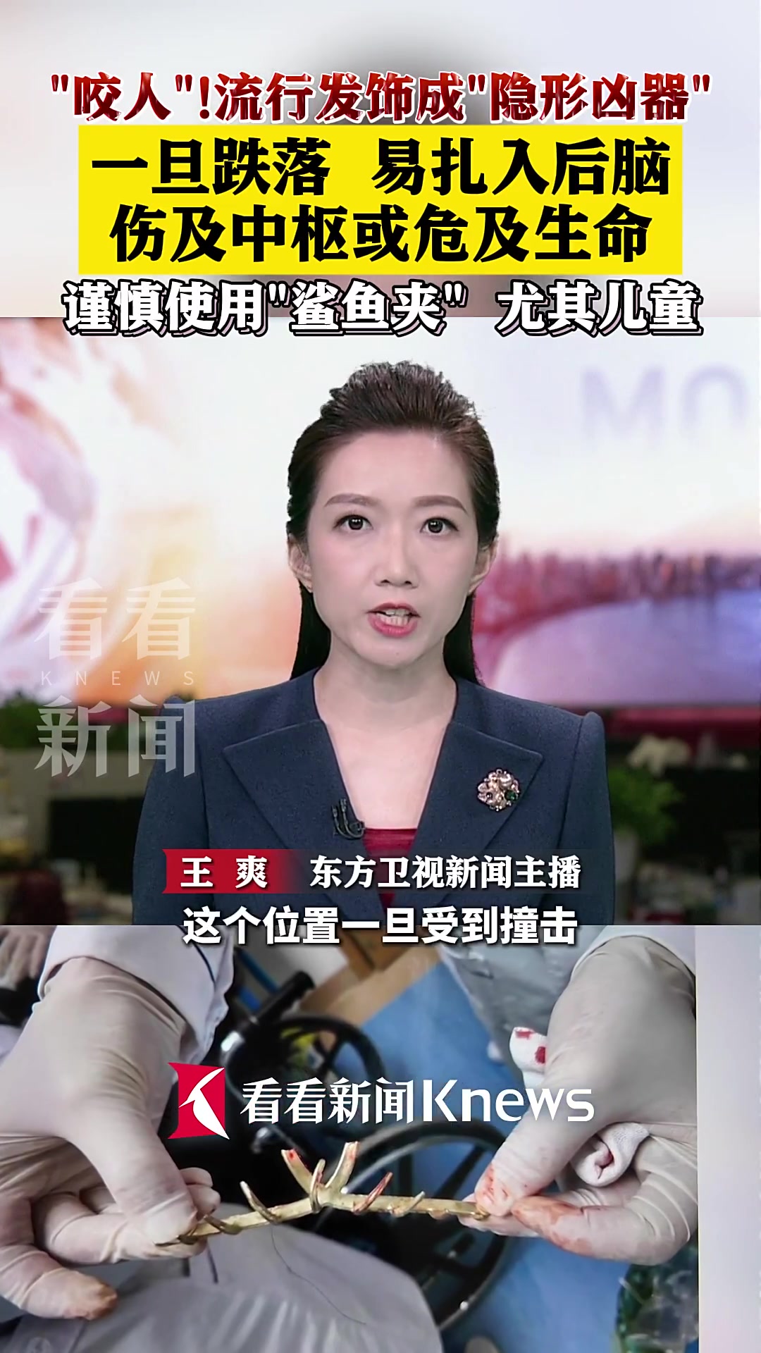 流行发饰成“隐形凶器” 谨慎使用“鲨鱼夹”