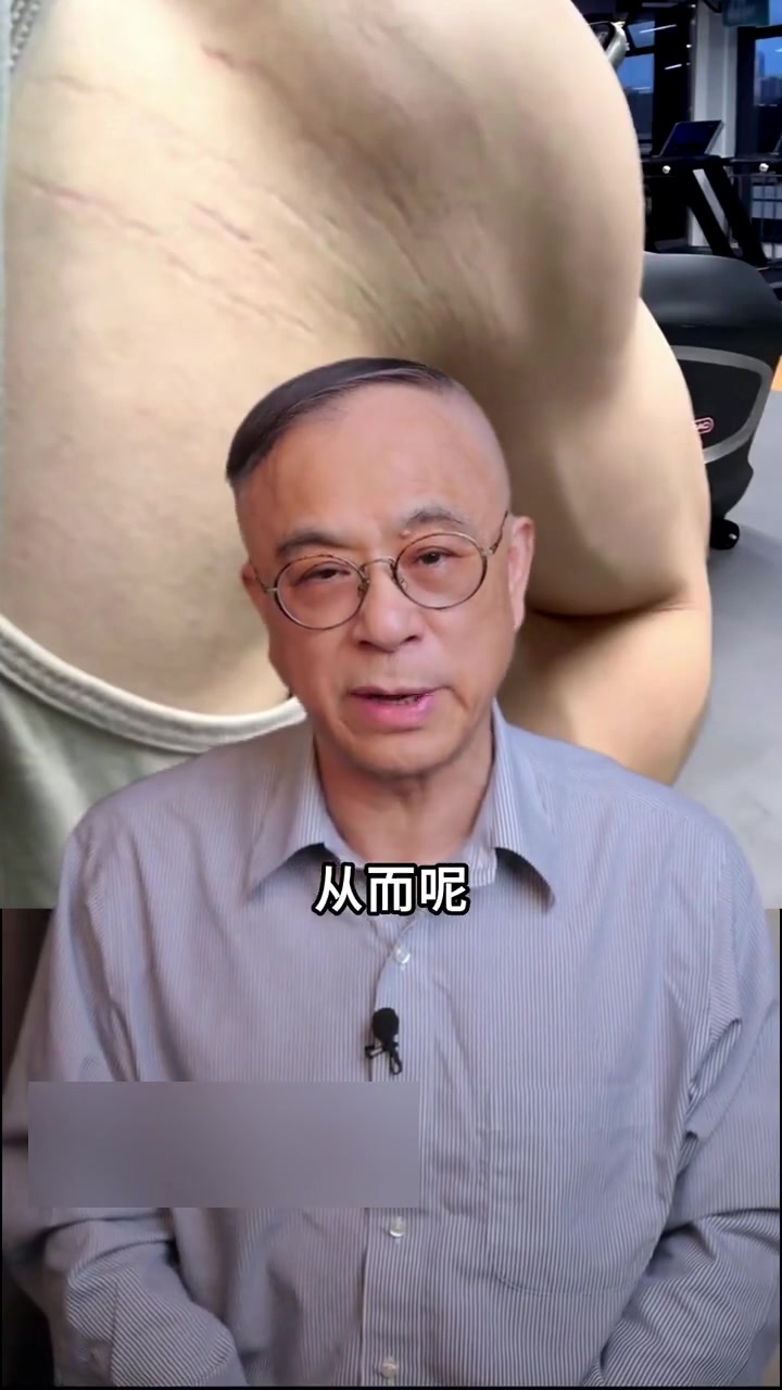 肌肉男也会有“肥胖纹”？