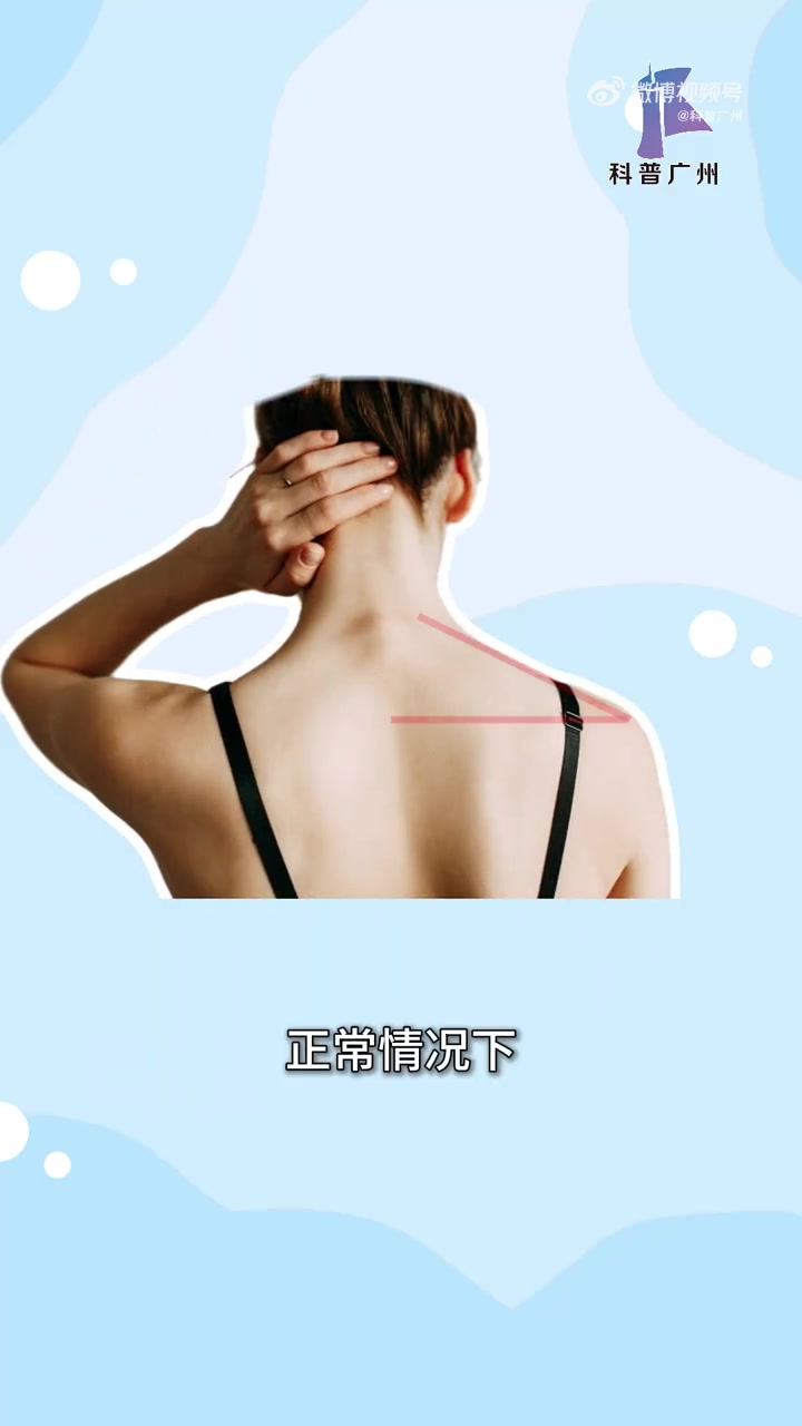 天鹅颈、直角肩、蝴蝶骨,这些被追捧的“完美体态”,真的健康吗?科普广州 体态健康