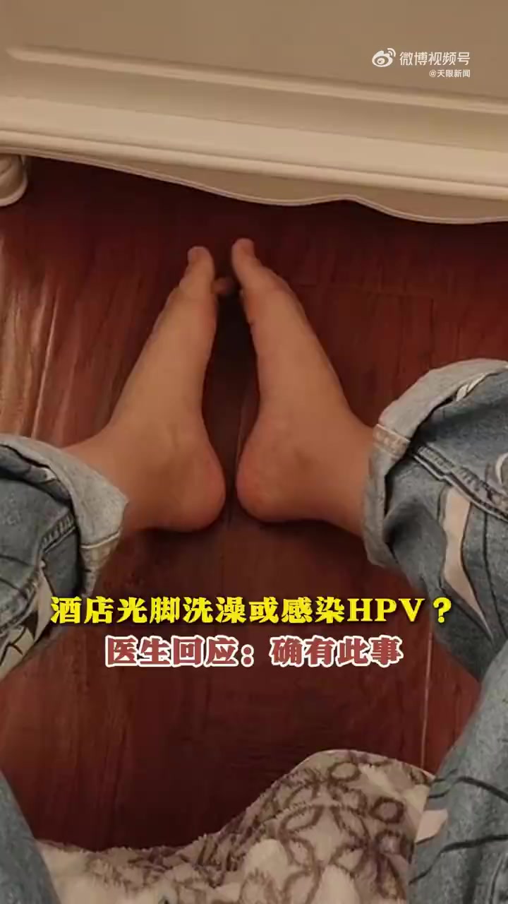 据《小鱼视频》报道,近日,在酒店光脚洗澡可能感染跖疣病毒引发网友热议,四川省中西医结合医院