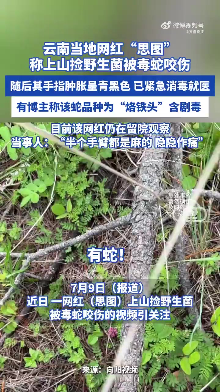 「云南当地网红上山捡野生菌被毒蛇咬伤:半个手臂都是麻的」7月9日(报道时间),近日,一名网