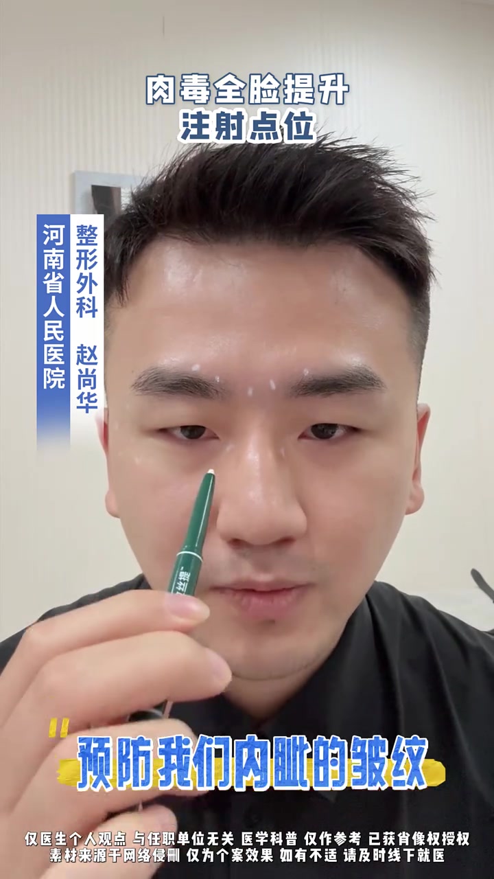 最全肉毒全脸注射点位！抗衰 全脸提升 河南省人民医院