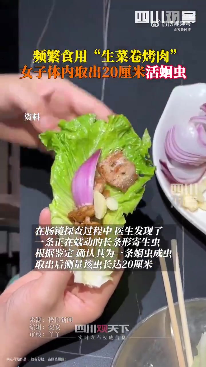 「女子频繁吃生菜卷烤肉体内取出20cm活蛔虫「衰」」近日,王女士因出现反复腹痛症状,严重影
