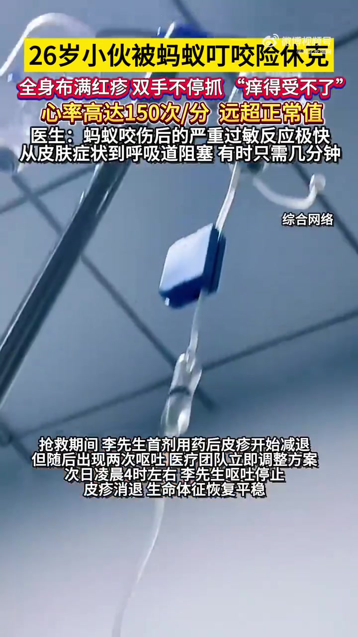 7月21日,广东深圳。26岁小伙被蚂蚁叮咬险休克,全身布满红疹,双手不停抓,心率高达150