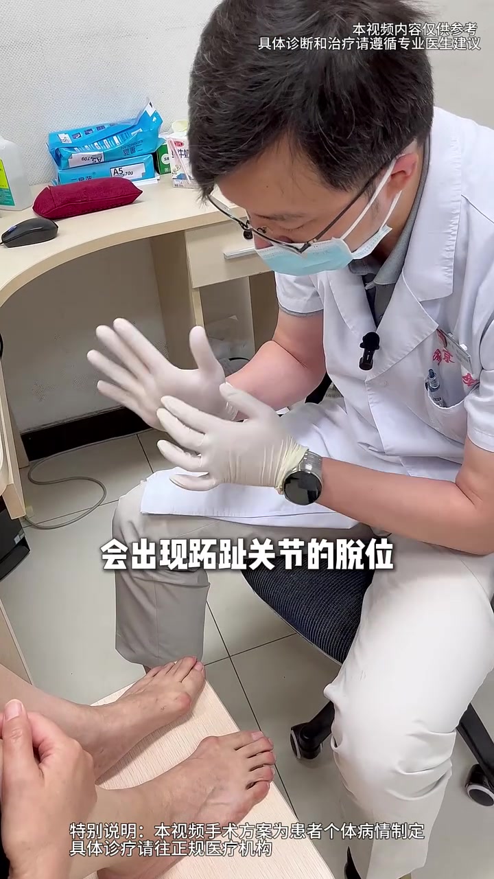 茧子鸡眼反反复复 原来问题在它呀！